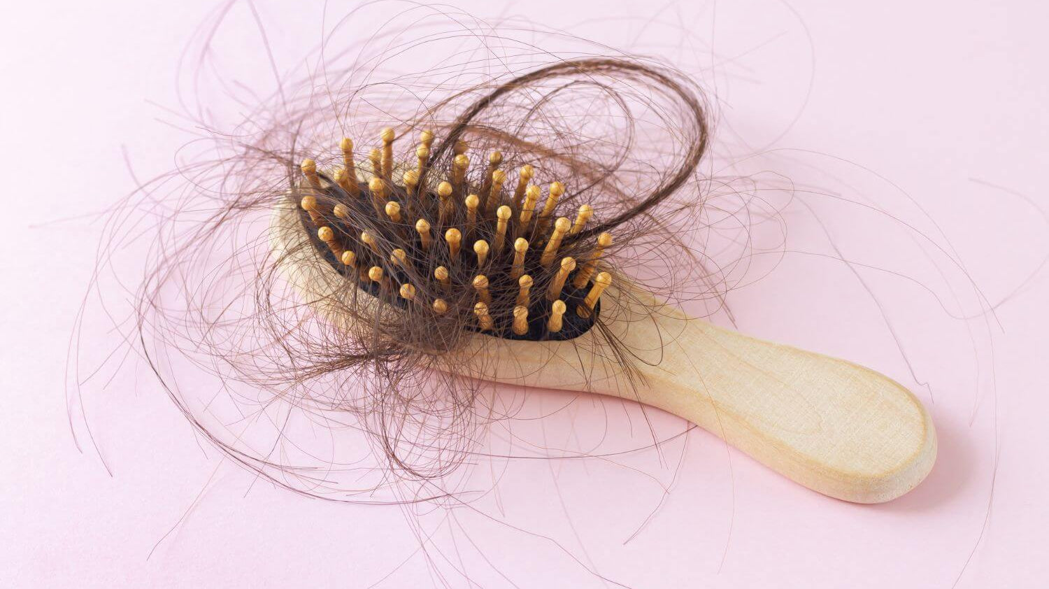 Причини и ефективни методи за лечение на косопад и оплешивяване