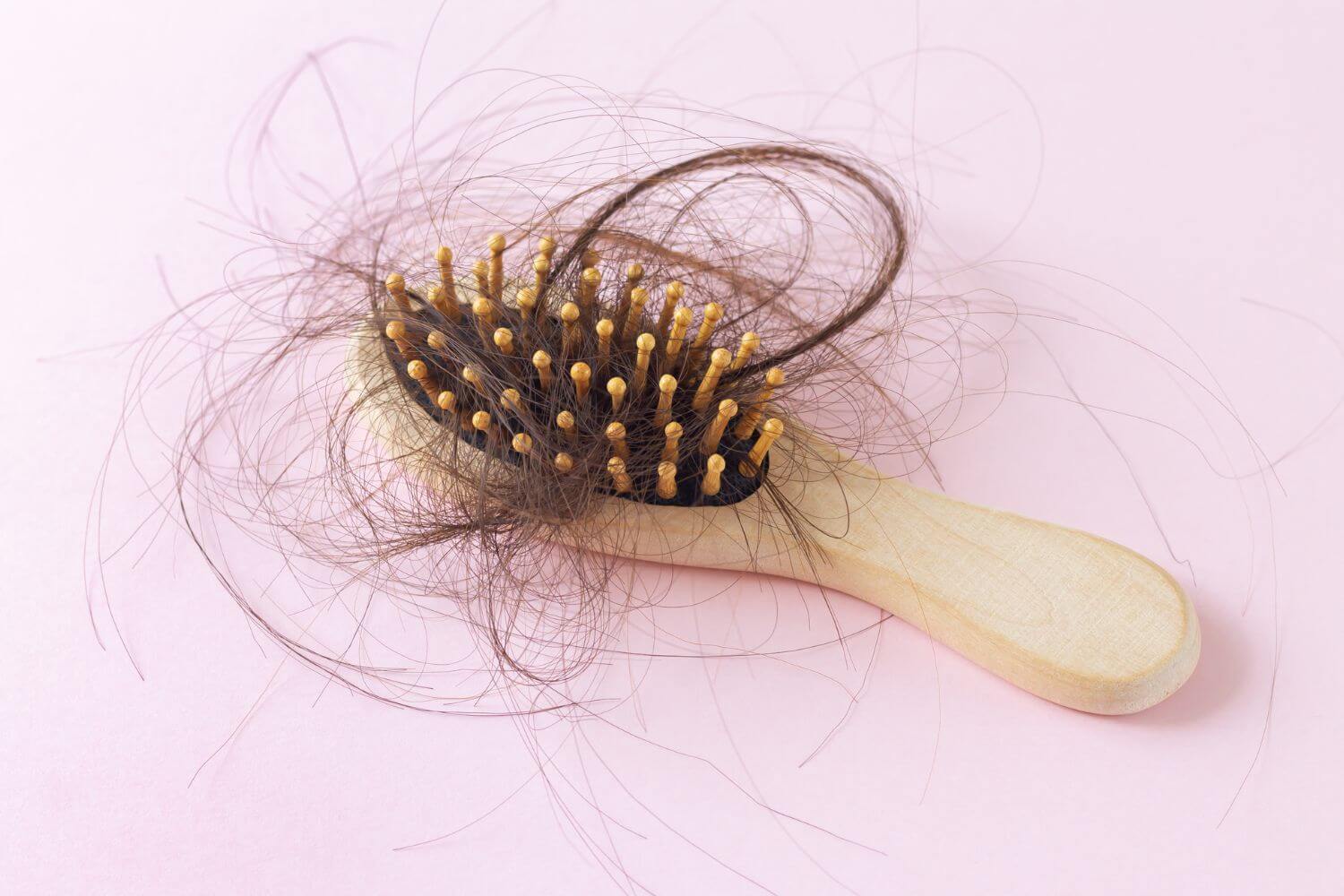 Причини и ефективни методи за лечение на косопад и оплешивяване